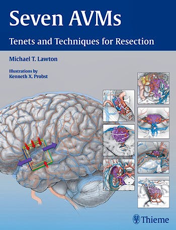 Portada del libro 9781604068757 Seven Avms. Tenets and Techniques for Resection