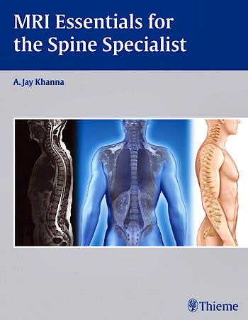 Portada del libro 9781604068771 Mri Essentials for the Spine Specialist