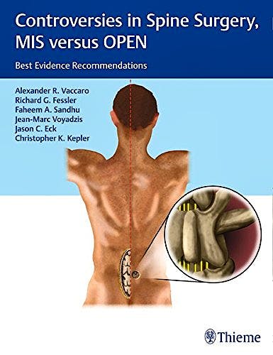 Portada del libro 9781604068818 Controversies in Spine Surgery, MIS Versus OPEN. Best Evidence Recommendations
