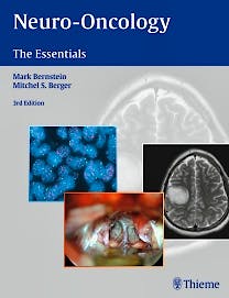 Portada del libro 9781604068832 Neuro-Oncology. the Essentials