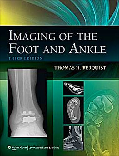 Portada del libro 9781605475721 Imaging of the Foot and Ankle