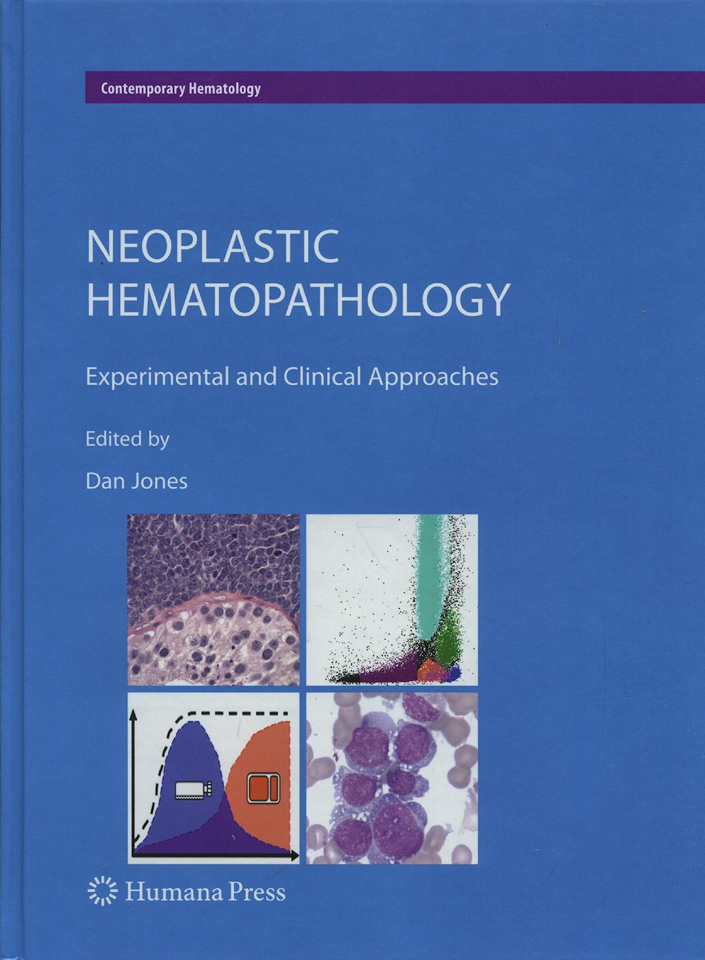 Portada del libro 9781607613831 Neoplastic Hematopathology. Experimental and Clinical Approaches