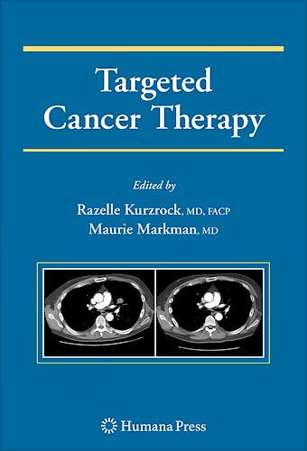 Portada del libro 9781607615989 Targeted Cancer Therapy