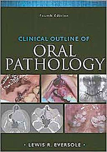 Portada del libro 9781607950158 Clinical Outline of Oral Pathology: Diagnosis and Treatment