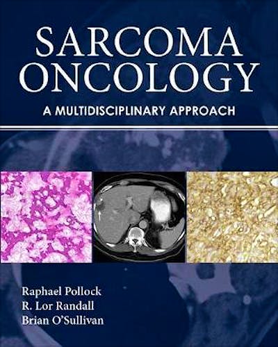 Portada del libro 9781607950172 Sarcoma Oncology. A Multidisciplinary Approach