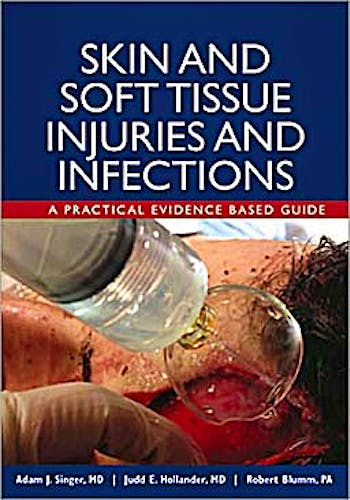 Portada del libro 9781607950295 Skin and Soft Tissue Injuries and Infections: A Practical Evidence Based Guide