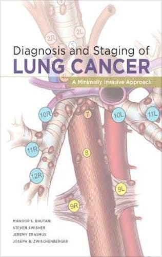 Portada del libro 9781607951100 Diagnosis and Staging of Lung Cancer. A Minimally Invasive Approach