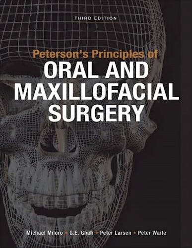 Portada del libro 9781607951117 Peterson's Principles of Oral and Maxillofacial Surgery, 2 Vols.