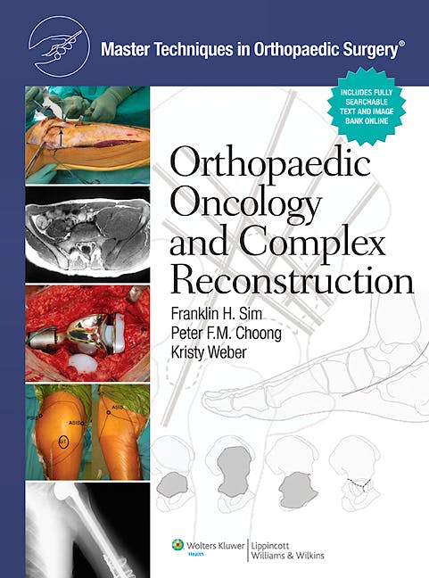 Portada del libro 9781608310432 Master Techniques in Orthopaedic Surgery. Orthopaedic Oncology and Complex Reconstruction (Online and Print)