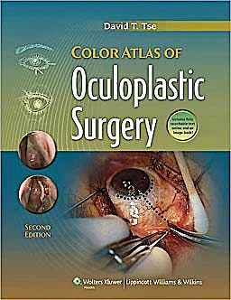 Color Atlas of Oculoplastic Surgery (Online and Print)