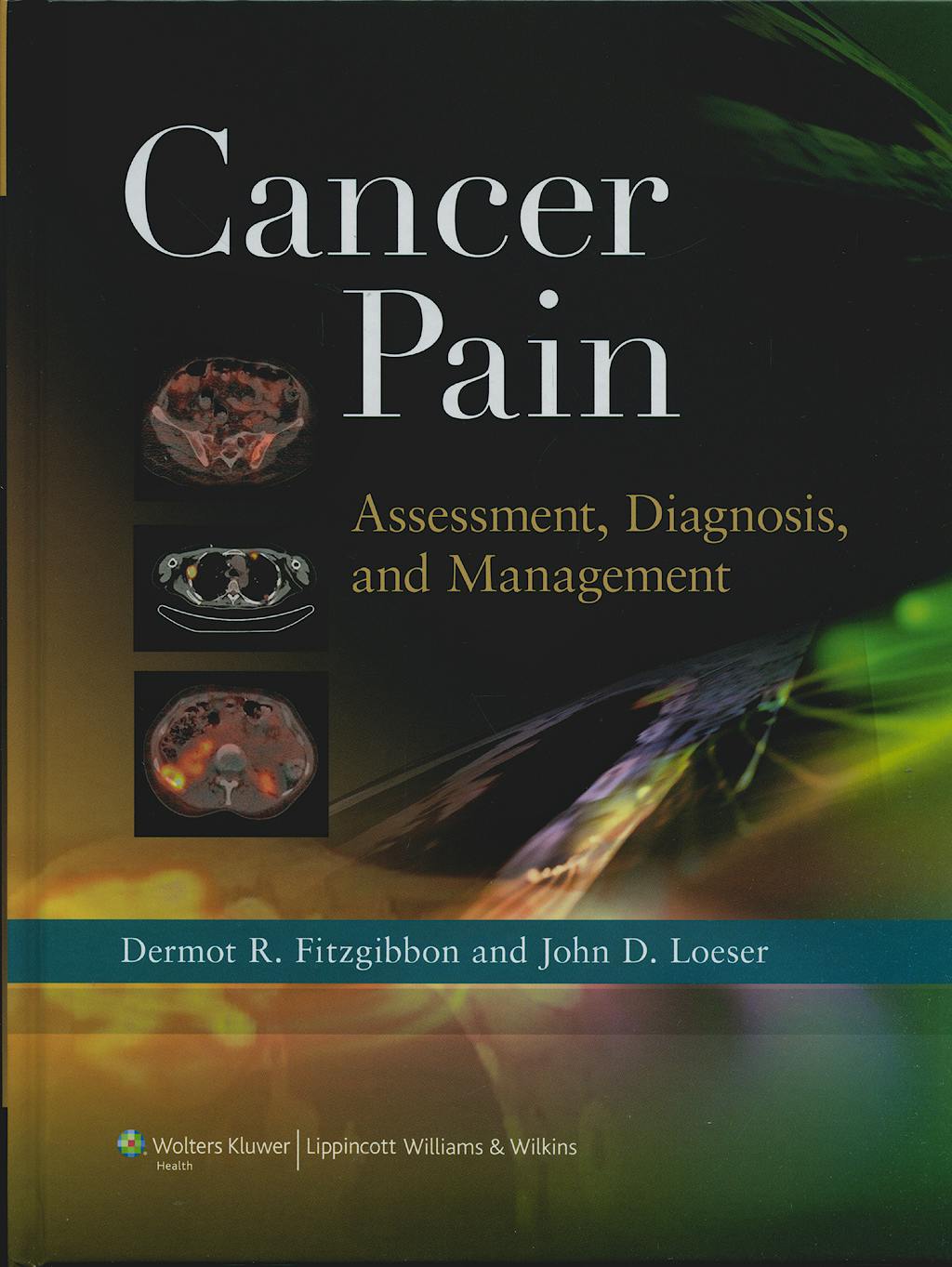 Portada del libro 9781608310890 Cancer Pain. Assessment, Diagnosis, and Management
