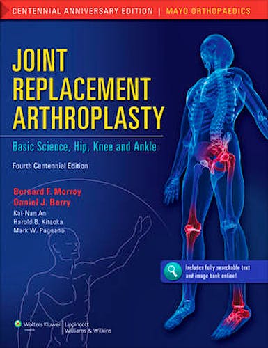 Portada del libro 9781608314706 Joint Replacement Arthroplasty. Basic Science, Hip, Knee, and Ankle