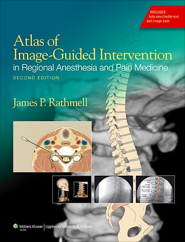 Portada del libro 9781608317042 Atlas of Image-Guided Intervention in Regional Anesthesia and Pain Medicine
