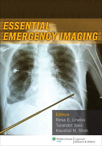 Portada del libro 9781608318933 Essential Emergency Imaging
