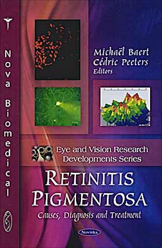 Portada del libro 9781608768844 Retinitis Pigmentosa: Causes, Diagnosis and Treatment