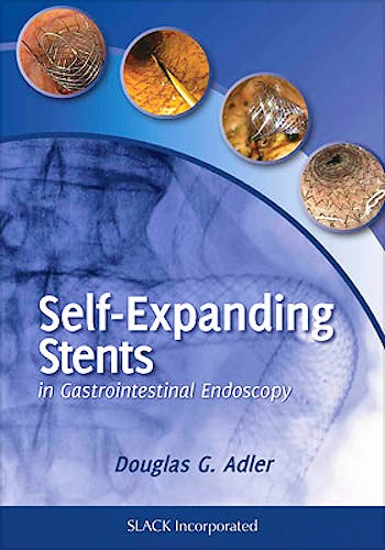 Portada del libro 9781617110283 Self-Expanding Stents in Gastrointestinal Endoscopy