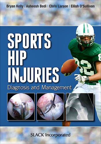 Portada del libro 9781617110467 Sports Hip Injuries. Diagnosis and Management