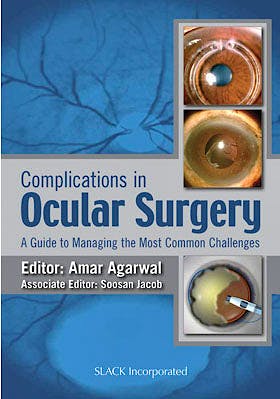 Portada del libro 9781617110542 Complications in Ocular Surgery. a Guide to Managing the Most Common Challenges