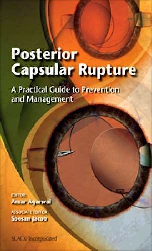 Portada del libro 9781617110719 Posterior Capsular Rupture. a Practical Guide to Prevention and Management