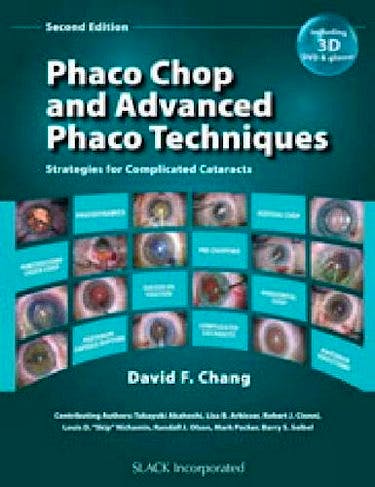 Portada del libro 9781617110757 Phaco Chop and Advanced Phaco Techniques. Strategies for Complicated Cataracts