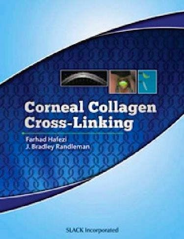 Portada del libro 9781617110764 Corneal Collagen Cross-Linking