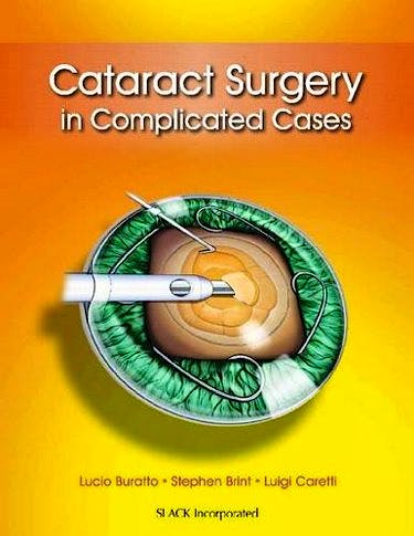 Portada del libro 9781617116070 Cataract Surgery in Complicated Cases