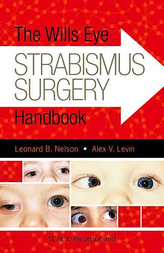 Portada del libro 9781617119682 The Wills Eye Strabismus Surgery Handbook