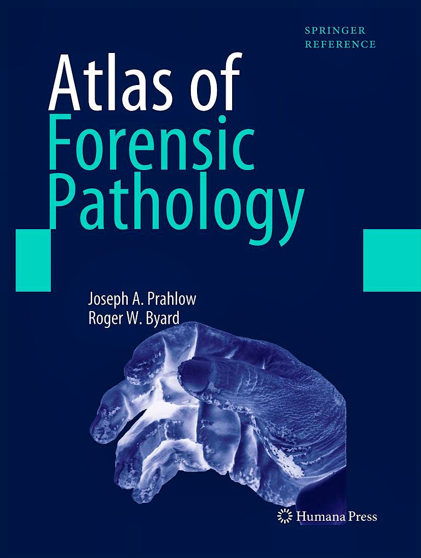 Portada del libro 9781617790577 Atlas of Forensic Pathology