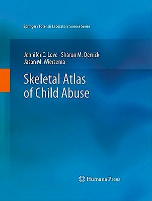 Portada del libro 9781617792151 Skeletal Atlas of Child Abuse (Springer's Forensic Laboratory Science Series)