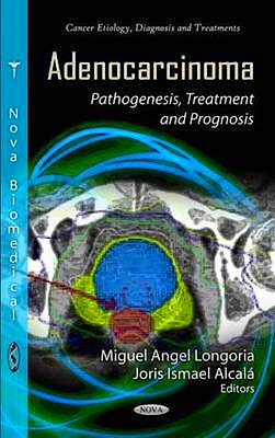 Portada del libro 9781619421738 Adenocarcinoma: Pathogenesis, Treatment and Prognosis