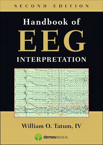 Portada del libro 9781620700167 Handbook of EEG Interpretation