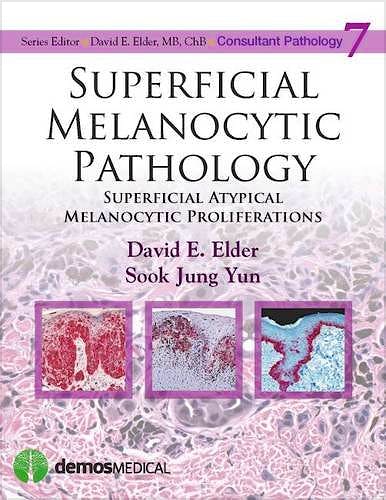 Portada del libro 9781620700235 Superficial Melanocytic Pathology. Superficial Atypical Melanocytic Proliferations (Consultant Pathology, Vol. 7)