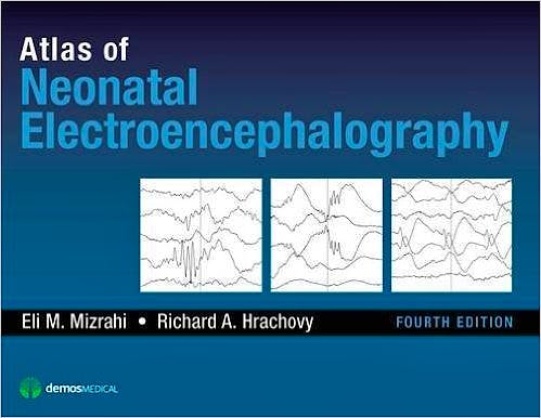 Portada del libro 9781620700679 Atlas of Neonatal Electroencephalography