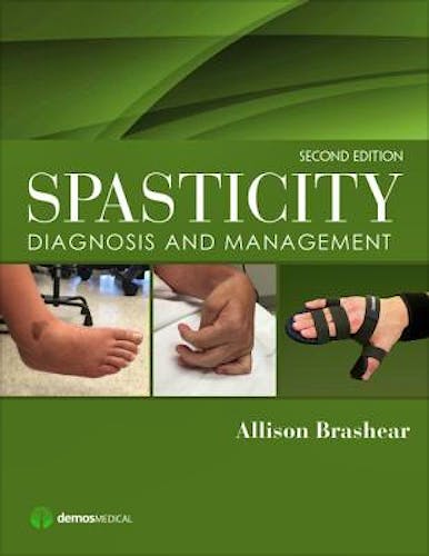 Portada del libro 9781620700723 Spasticity. Diagnosis and Management
