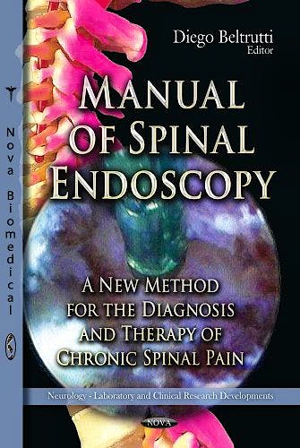 Portada del libro 9781622572502 Manual of Spinal Endoscopy. A New Method for the Diagnosis and Therapy of Chronic Spinal Pain