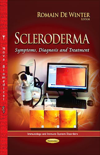 Portada del libro 9781626188020 Scleroderma. Symptoms, Diagnosis & Treatment (Immunology & Immune System Series)