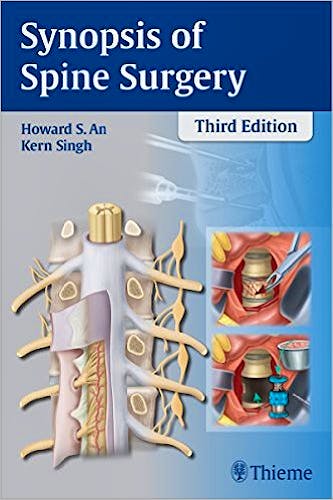 Portada del libro 9781626230309 Synopsis of Spine Surgery