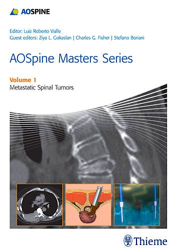 Portada del libro 9781626230460 AOSpine Masters Series, Vol. 1: Metastatic Spinal Tumors