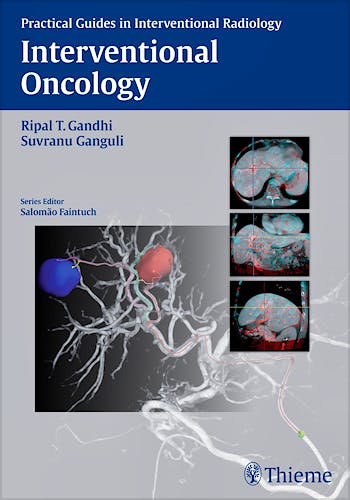 Portada del libro 9781626230811 Interventional Oncology