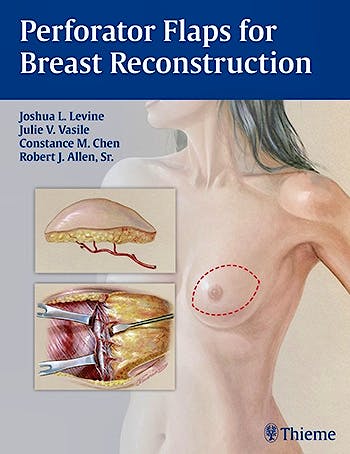 Portada del libro 9781626230941 Perforator Flaps for Breast Reconstruction