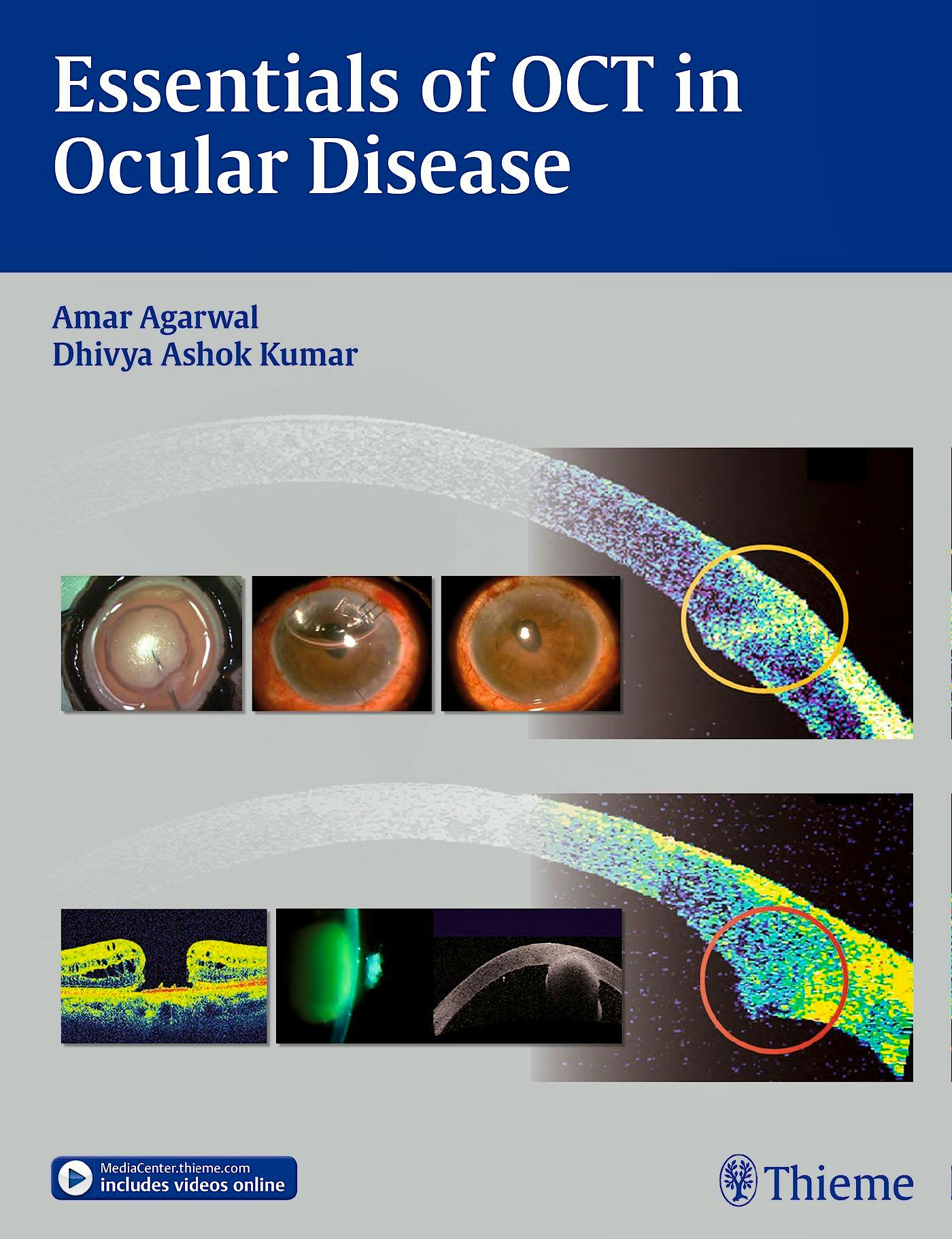 Portada del libro 9781626230989 Essentials of Oct in Ocular Disease
