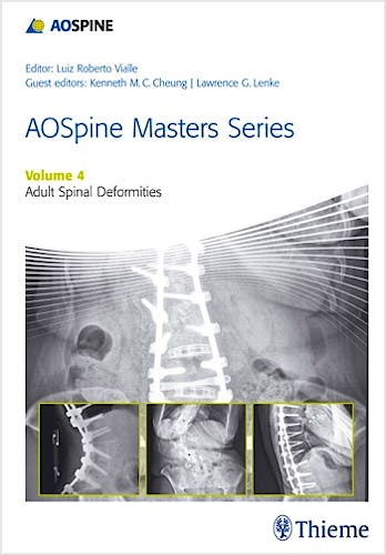 Portada del libro 9781626231009 AOSpine Masters Series, Vol. 4: Adult Spinal Deformities