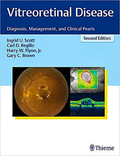 Portada del libro 9781626231337 Vitroretinal Disease. Diagnosis, Management and Clinical Pearls