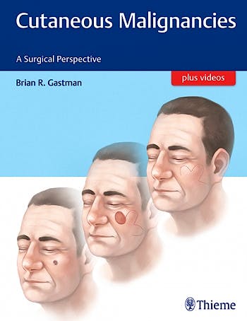 Portada del libro 9781626231474 Cutaneous Malignancies. A Surgical Perspective