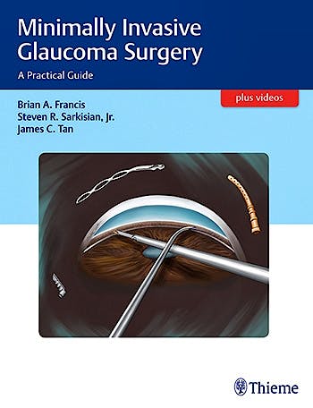 Portada del libro 9781626231566 Minimally Invasive Glaucoma Surgery. a Practical Guide