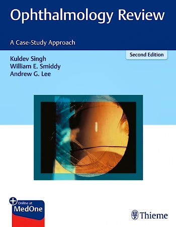 Portada del libro 9781626231764 Ophthalmology Review. A Case-Study Approach