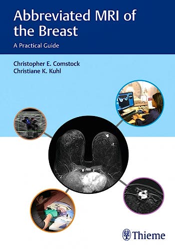 Portada del libro 9781626231931 Abbreviated MRI of the Breast. A Practical Guide