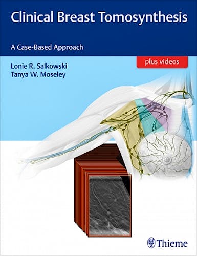 Portada del libro 9781626232082 Clinical Breast Tomosynthesis. A Case-Based Approach + Videos Online