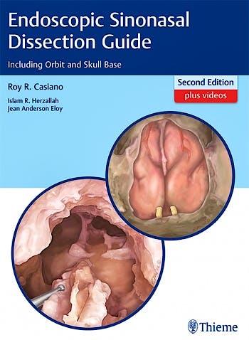 Portada del libro 9781626232105 Endoscopic Sinonasal Dissection Guide including Orbit and Skull Base + Videos