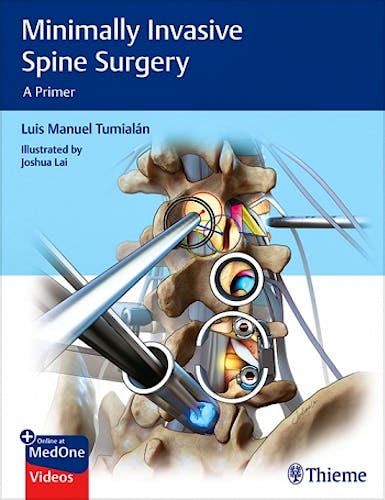 Portada del libro 9781626232181 Minimally Invasive Spine Surgery. A Primer